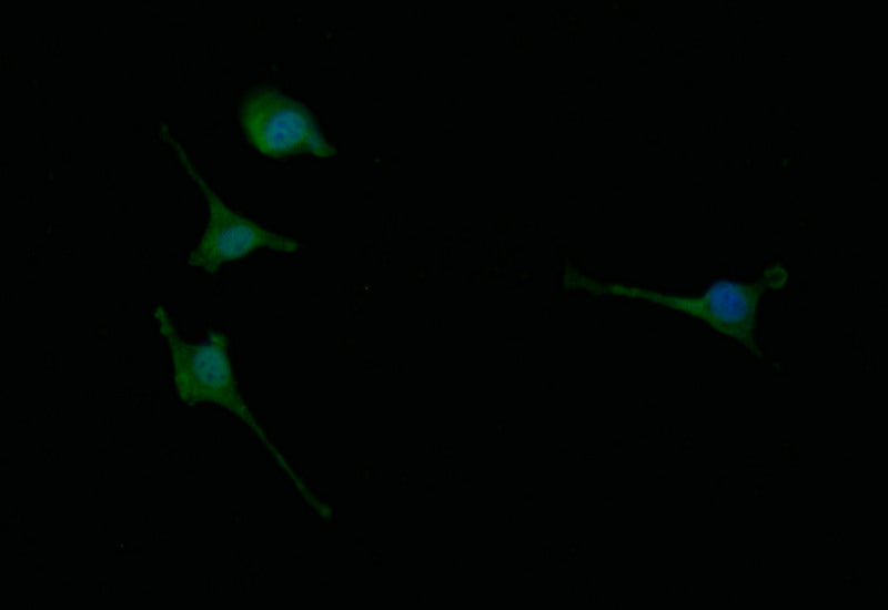 Immunofluorescence staining of SH-SY5Y with RAC07246 at 1:30, counter-stained with DAPI. The cells were fixed in 4% formaldehyde and blocked in 10% normal Goat Serum. The cells were then incubated with the antibody overnight at 4Â°C. The secondary antibody was Alexa Fluor 498-congugated AffiniPure Goat Anti-Rabbit IgG(H+L).