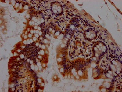 IHC image of RAC07247 diluted at 1:100 and staining in paraffin-embedded human small intestine tissue performed on a Leica BondTM system. After dewaxing and hydration, antigen retrieval was mediated by high pressure in a citrate buffer (pH 6.0). Section was blocked with 10% normal goat serum 30min at RT. Then primary antibody (1% BSA) was incubated at 4? overnight. The primary is detected by a Goat anti-rabbit IgG polymer labeled by HRP and visualized using 0.05% DAB.