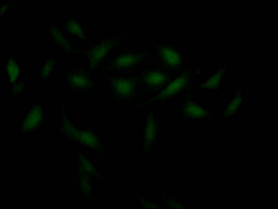 Immunofluorescence staining of Hela Cells with RAC07247 at 1:50, counter-stained with DAPI. The cells were fixed in 4% formaldehyde, permeated by 0.2% TritonX-100, and blocked in 10% normal Goat Serum. The cells were then incubated with the antibody overnight at 4?. Nuclear DNA was labeled in blue with DAPI. The secondary antibody was FITC-conjugated AffiniPure Goat Anti-Rabbit IgG (H+L).