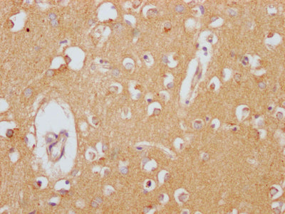 IHC image of RAC07254 diluted at 1:100 and staining in paraffin-embedded human brain tissue performed on a Leica BondTM system. After dewaxing and hydration, antigen retrieval was mediated by high pressure in a citrate buffer (pH 6.0). Section was blocked with 10% normal goat serum 30min at RT. Then primary antibody (1% BSA) was incubated at 4? overnight. The primary is detected by a Goat anti-rabbit IgG polymer labeled by HRP and visualized using 0.05% DAB.