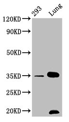 Western Blot; Positive WB detected in: 293 whole cell lysate, Mouse lung tissue; All lanes: CNN1 antibody at 1.05ug/ml; Secondary; Goat polyclonal to rabbit IgG at 1/50000 dilution; Predicted band size: 34, 32 KDa; Observed band size: 34 KDa