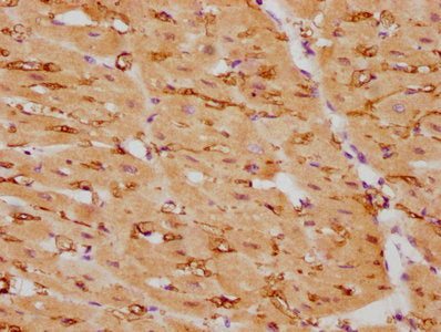 IHC image of RAC07257 diluted at 1:105 and staining in paraffin-embedded human heart tissue performed on a Leica BondTM system. After dewaxing and hydration, antigen retrieval was mediated by high pressure in a citrate buffer (pH 6.0). Section was blocked with 10% normal goat serum 30min at RT. Then primary antibody (1% BSA) was incubated at 4? overnight. The primary is detected by a biotinylated secondary antibody and visualized using an HRP conjugated SP system.