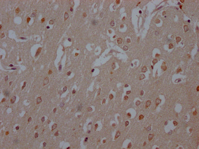 IHC image of RAC07259 diluted at 1:100 and staining in paraffin-embedded human brain tissue performed on a Leica BondTM system. After dewaxing and hydration, antigen retrieval was mediated by high pressure in a citrate buffer (pH 6.0). Section was blocked with 10% normal goat serum 30min at RT. Then primary antibody (1% BSA) was incubated at 4? overnight. The primary is detected by a Goat anti-rabbit IgG polymer labeled by HRP and visualized using 0.05% DAB.