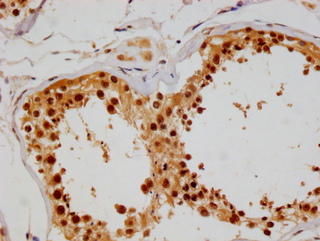 IHC image of RAC07260 diluted at 1:100 and staining in paraffin-embedded human testis tissue performed on a Leica BondTM system. After dewaxing and hydration, antigen retrieval was mediated by high pressure in a citrate buffer (pH 6.0). Section was blocked with 10% normal goat serum 30min at RT. Then primary antibody (1% BSA) was incubated at 4Â°C overnight. The primary is detected by a Goat anti-rabbit polymer IgG labeled by HRP and visualized using 0.05% DAB.