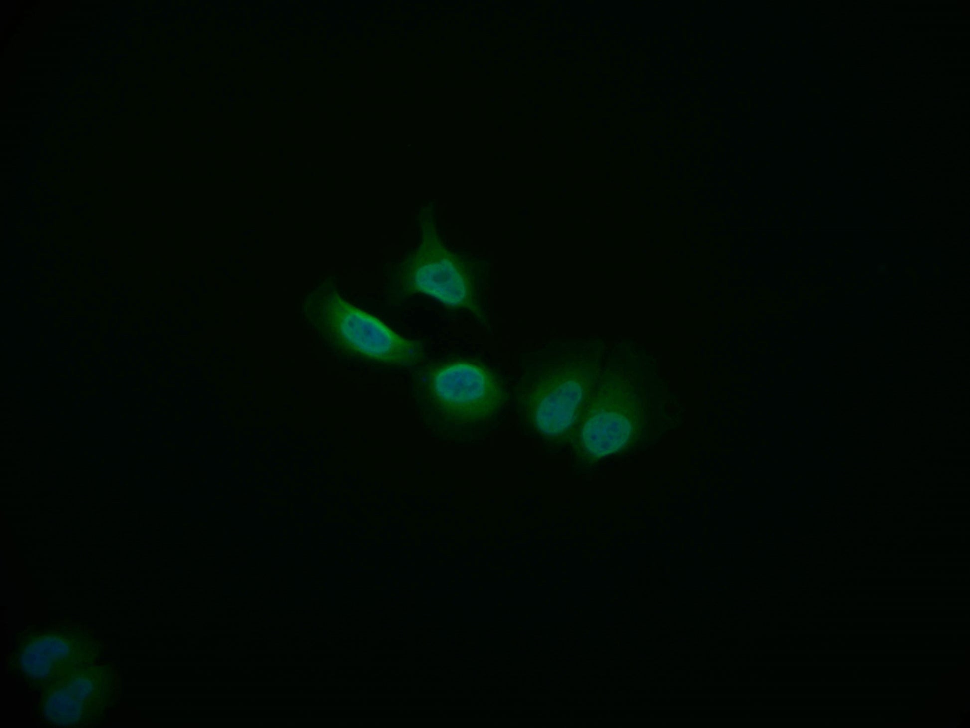 Immunofluorescence staining of A549 cell with RAC07260 at 1:50, counter-stained with DAPI. The cells were fixed in 4% formaldehyde and blocked in 10% normal Goat Serum. The cells were then incubated with the antibody overnight at 4Â°C. The secondary antibody was Alexa Fluor 535-congugated AffiniPure Goat Anti-Rabbit IgG(H+L).