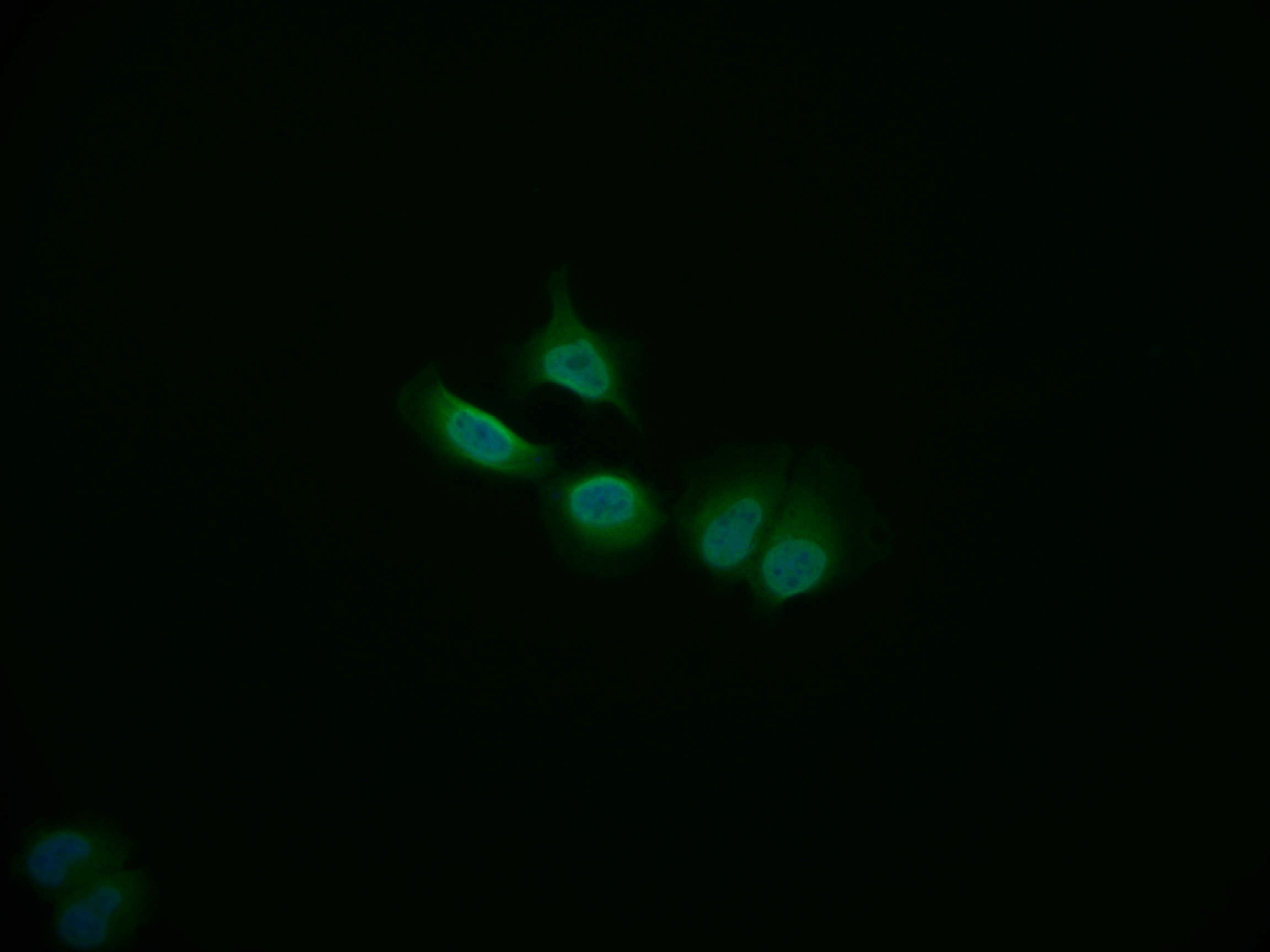 Immunofluorescence staining of A549 cell with RAC07260 at 1:50, counter-stained with DAPI. The cells were fixed in 4% formaldehyde and blocked in 10% normal Goat Serum. The cells were then incubated with the antibody overnight at 4Â°C. The secondary antibody was Alexa Fluor 535-congugated AffiniPure Goat Anti-Rabbit IgG(H+L).
