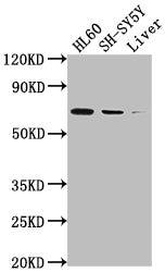 Western Blot; Positive WB detected in: HL60 whole cell lysate, SH-SY5Y whole cell lysate, Mouse liver tissue; All lanes: PTGS1 antibody at 1:2000; Secondary; Goat polyclonal to rabbit IgG at 1/50000 dilution; Predicted band size: 69, 65, 62, 57, 72, 73 kDa; Observed band size: 72 kDa