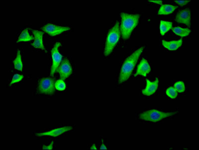 Immunofluorescence staining of HepG2 Cells with RAC07262 at 1:50, counter-stained with DAPI. The cells were fixed in 4% formaldehyde, permeated by 0.2% TritonX-100, and blocked in 10% normal Goat Serum. The cells were then incubated with the antibody overnight at 4?. Nuclear DNA was labeled in blue with DAPI. The secondary antibody was FITC-conjugated AffiniPure Goat Anti-Rabbit IgG (H+L).