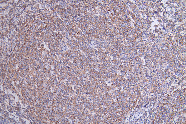 IHC image of RAC07263 diluted at 1:50 and staining in paraffin-embedded human tonsil tissue performed on a Leica BondTM system. After dewaxing and hydration, antigen retrieval was mediated by high pressure in a citrate buffer (pH 6.0). Section was blocked with 10% normal goat serum 30min at RT. Then primary antibody (1% BSA) was incubated at 4Â°C overnight. The primary is detected by a Goat anti-rabbit polymer IgG labeled by HRP and visualized using 0.17% DAB.