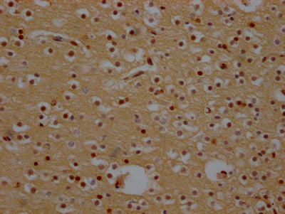 IHC image of RAC07265 diluted at 1:100 and staining in paraffin-embedded human brain tissue performed on a Leica BondTM system. After dewaxing and hydration, antigen retrieval was mediated by high pressure in a citrate buffer (pH 6.0). Section was blocked with 10% normal goat serum 30min at RT. Then primary antibody (1% BSA) was incubated at 4? overnight. The primary is detected by a Goat anti-rabbit IgG polymer labeled by HRP and visualized using 0.05% DAB.