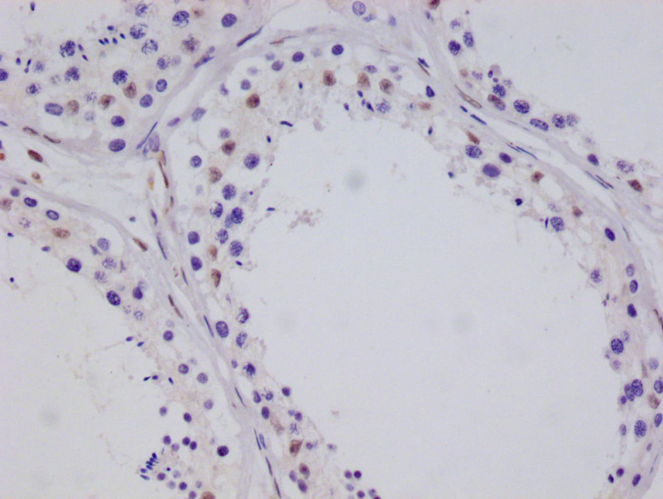 IHC image of RAC07267 diluted at 1:100 and staining in paraffin-embedded human testis tissue performed on a Leica BondTM system. After dewaxing and hydration, antigen retrieval was mediated by high pressure in a citrate buffer (pH 6.0). Section was blocked with 10% normal goat serum 30min at RT. Then primary antibody (1% BSA) was incubated at 4Â°C overnight. The primary is detected by a Goat anti-rabbit polymer IgG labeled by HRP and visualized using 0.05% DAB.