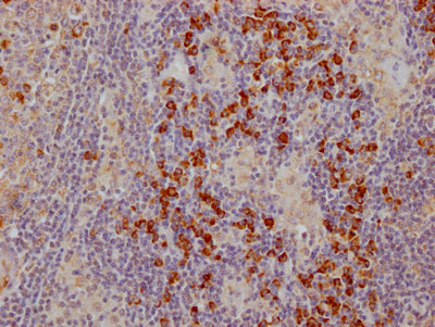 IHC image of RAC07270 diluted at 1:100 and staining in paraffin-embedded human lymph node tissue performed on a Leica BondTM system. After dewaxing and hydration, antigen retrieval was mediated by high pressure in a citrate buffer (pH 6.0). Section was blocked with 10% normal goat serum 30min at RT. Then primary antibody (1% BSA) was incubated at 4? overnight. The primary is detected by a Goat anti-rabbit IgG polymer labeled by HRP and visualized using 0.05% DAB.