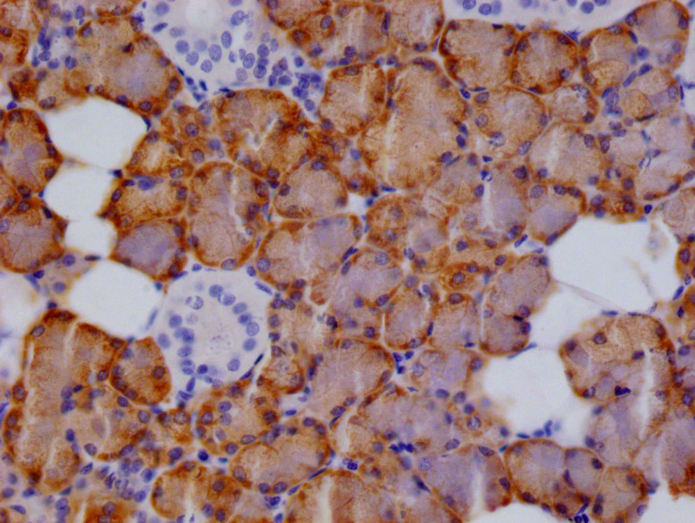 IHC image of RAC07271 diluted at 1:100 and staining in paraffin-embedded human salivary gland tissue performed on a Leica BondTM system. After dewaxing and hydration, antigen retrieval was mediated by high pressure in a citrate buffer (pH 6.0). Section was blocked with 10% normal goat serum 30min at RT. Then primary antibody (1% BSA) was incubated at 4Â°C overnight. The primary is detected by a Goat anti-rabbit polymer IgG labeled by HRP and visualized using 0.05% DAB.