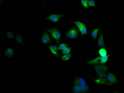 Immunofluorescence staining of Hela Cells with RAC07273 at 1:50, counter-stained with DAPI. The cells were fixed in 4% formaldehyde, permeated by 0.2% TritonX-100, and blocked in 10% normal Goat Serum. The cells were then incubated with the antibody overnight at 4?. Nuclear DNA was labeled in blue with DAPI. The secondary antibody was FITC-conjugated AffiniPure Goat Anti-Rabbit IgG (H+L).