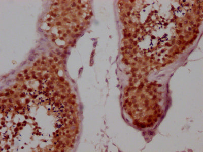 IHC image of RAC07275 diluted at 1:100 and staining in paraffin-embedded human testis tissue performed on a Leica BondTM system. After dewaxing and hydration, antigen retrieval was mediated by high pressure in a citrate buffer (pH 6.0). Section was blocked with 10% normal goat serum 30min at RT. Then primary antibody (1% BSA) was incubated at 4? overnight. The primary is detected by a Goat anti-rabbit IgG polymer labeled by HRP and visualized using 0.05% DAB.