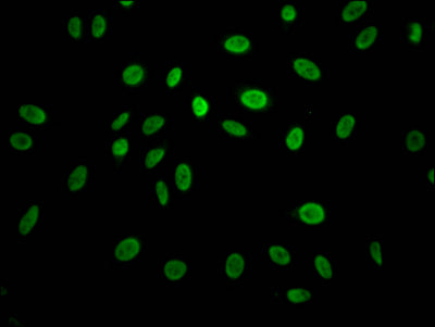 Immunofluorescence staining of Hela Cells with RAC07275 at 1:50, counter-stained with DAPI. The cells were fixed in 4% formaldehyde, permeated by 0.2% TritonX-100, and blocked in 10% normal Goat Serum. The cells were then incubated with the antibody overnight at 4?. Nuclear DNA was labeled in blue with DAPI. The secondary antibody was FITC-conjugated AffiniPure Goat Anti-Rabbit IgG (H+L).