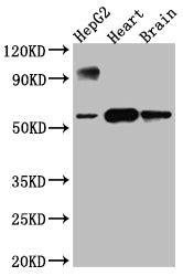 Western Blot; Positive WB detected in: HepG2 whole cell lysate, Rat Heart whole cell lysate, Rat Brain whole cell lysate; All lanes: CYP17A1 antibody at 1:1000; Secondary; Goat polyclonal to rabbit IgG at 1/50000 dilution; Predicted band size: 58 kDa; Observed band size: 58 kDa