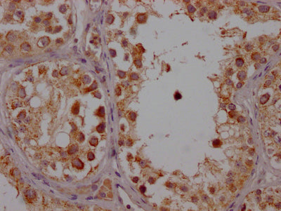 IHC image of RAC07278 diluted at 1:100 and staining in paraffin-embedded human testis tissue performed on a Leica BondTM system. After dewaxing and hydration, antigen retrieval was mediated by high pressure in a citrate buffer (pH 6.0). Section was blocked with 10% normal goat serum 30min at RT. Then primary antibody (1% BSA) was incubated at 4? overnight. The primary is detected by a Goat anti-rabbit IgG polymer labeled by HRP and visualized using 0.05% DAB.