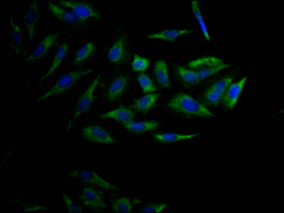 Immunofluorescence staining of Hela Cells with RAC07278 at 1:50, counter-stained with DAPI. The cells were fixed in 4% formaldehyde, permeated by 0.2% TritonX-100, and blocked in 10% normal Goat Serum. The cells were then incubated with the antibody overnight at 4?. Nuclear DNA was labeled in blue with DAPI. The secondary antibody was FITC-conjugated AffiniPure Goat Anti-Rabbit IgG (H+L).