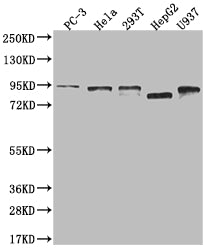 Western Blot; Positive WB detected in: PC3 whole cell lysate, Hela whole cell lysate, 293T whole cell lysate, HepG2 whole cell lysate, U937 whole cell lysate; All lanes: DBF4 antibody at 1:2000; Secondary; Goat polyclonal to rabbit IgG at 1/50000 dilution; Predicted band size: 77, 27 kDa; Observed band size: 72-95 kDa