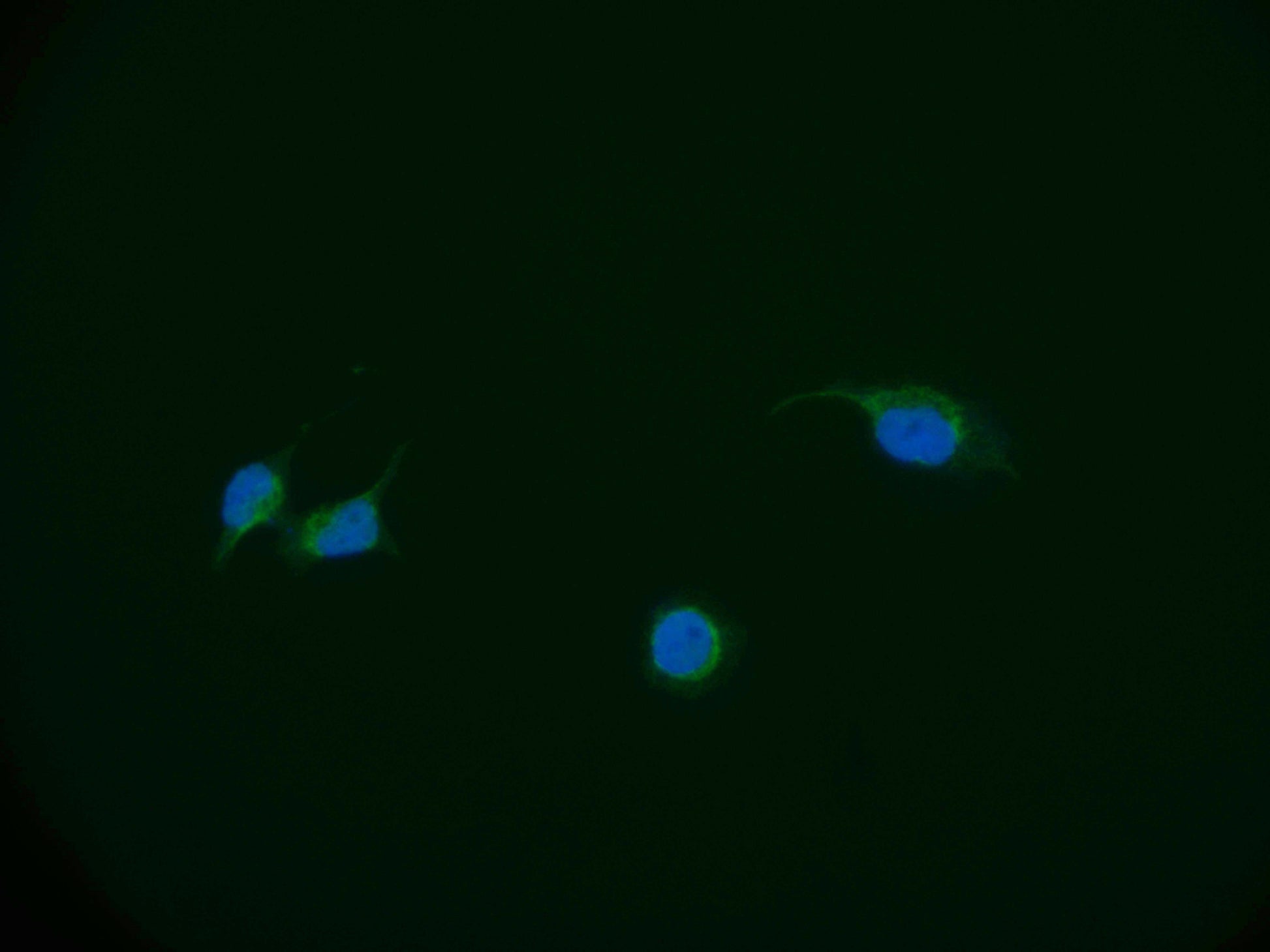 Immunofluorescence staining of A549 cell with RAC07282 at 1:50, counter-stained with DAPI. The cells were fixed in 4% formaldehyde and blocked in 10% normal Goat Serum. The cells were then incubated with the antibody overnight at 4Â°C. The secondary antibody was Alexa Fluor 551-congugated AffiniPure Goat Anti-Rabbit IgG(H+L).