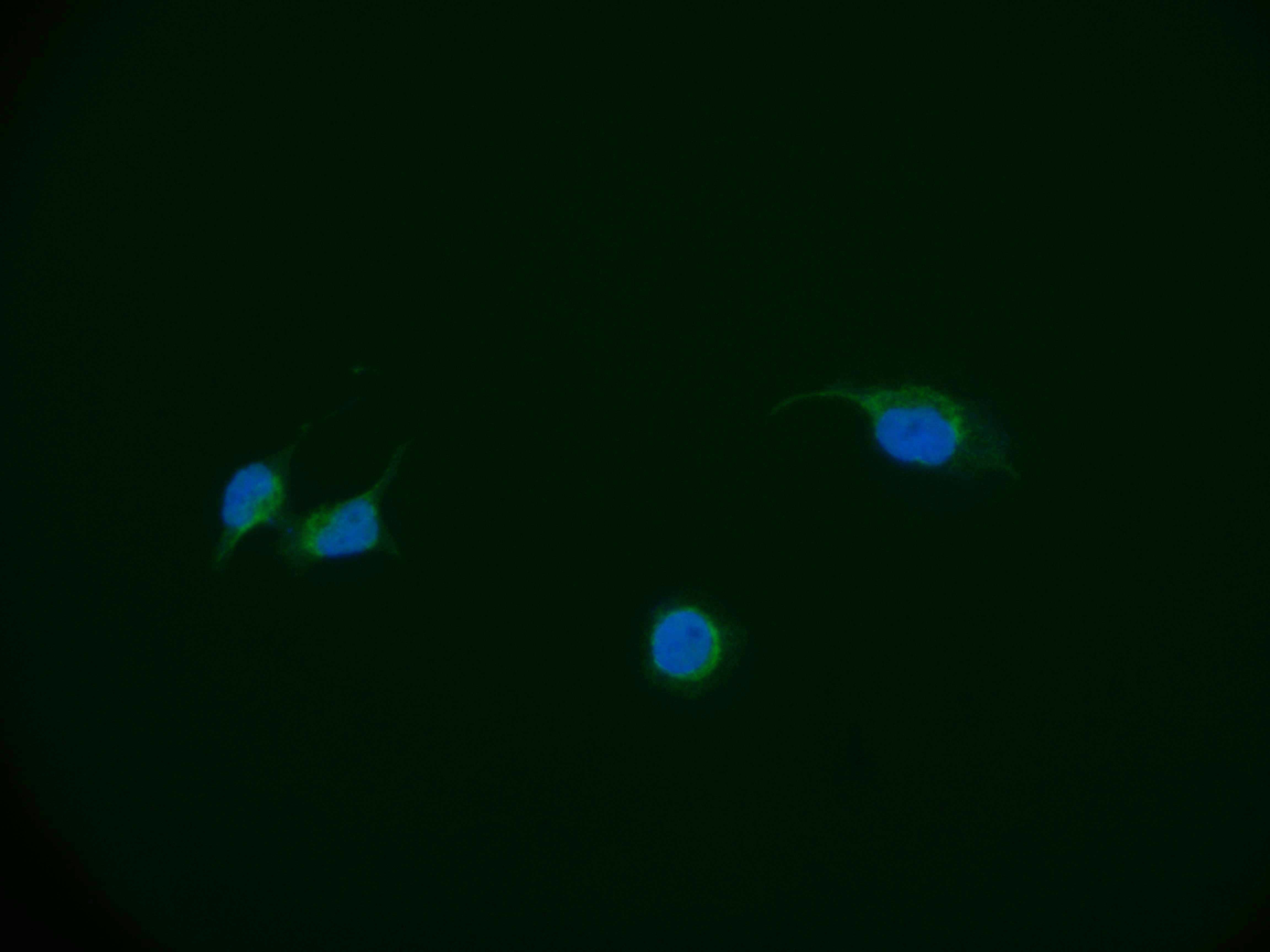 Immunofluorescence staining of A549 cell with RAC07282 at 1:50, counter-stained with DAPI. The cells were fixed in 4% formaldehyde and blocked in 10% normal Goat Serum. The cells were then incubated with the antibody overnight at 4Â°C. The secondary antibody was Alexa Fluor 551-congugated AffiniPure Goat Anti-Rabbit IgG(H+L).