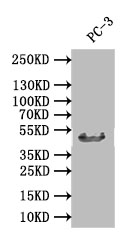 Western Blot; Positive WB detected in: PC-3 whole cell lysate; All lanes: DDB2 antibody at 1:1000; Secondary; Goat polyclonal to rabbit IgG at 1/50000 dilution; Predicted band size: 47 kDa; Observed band size: 47 kDa