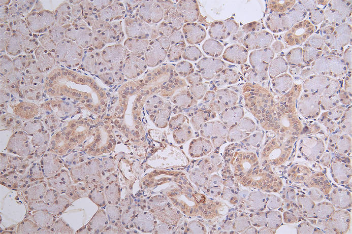 IHC image of RAC07283 diluted at 1:50 and staining in paraffin-embedded human salivary gland tissue performed on a Leica BondTM system. After dewaxing and hydration, antigen retrieval was mediated by high pressure in a citrate buffer (pH 6.0). Section was blocked with 10% normal goat serum 30min at RT. Then primary antibody (1% BSA) was incubated at 4Â°C overnight. The primary is detected by a Goat anti-rabbit polymer IgG labeled by HRP and visualized using 0.46% DAB.