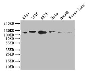Western Blot; Positive WB detected in: A549 whole cell lysate, SY5Y whole cell lysate, A375 whole cell lysate, HEPG2 whole cell lysate, Mouse Lung tissue lysate; All lanes: DDR2 antibody at 1:1000; Secondary; Goat polyclonal to rabbit IgG at 1/50000 dilution; Predicted band size: 96 kDa; Observed band size: 110 kDa