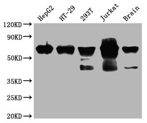 Western Blot; Positive WB detected in: HepG2 whole cell lysate, HT-29 whole cell lysate, 293T whole cell lysate, Jurkat whole cell lysate, Mouse brain tissue; All lanes: DDX5 antibody at 1:2000; Secondary; Goat polyclonal to rabbit IgG at 1/50000 dilution; Predicted band size: 70, 61 kDa; Observed band size: 70 kDa