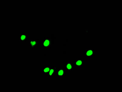 Immunofluorescence staining of HepG2 Cells with RAC07286 at 1:50, counter-stained with DAPI. The cells were fixed in 4% formaldehyde, permeated by 0.2% TritonX-100, and blocked in 10% normal Goat Serum. The cells were then incubated with the antibody overnight at 4?. Nuclear DNA was labeled in blue with DAPI. The secondary antibody was FITC-conjugated AffiniPure Goat Anti-Rabbit IgG (H+L).