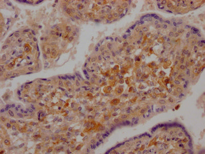 IHC image of RAC07287 diluted at 1:100 and staining in paraffin-embedded human placenta tissue performed on a Leica BondTM system. After dewaxing and hydration, antigen retrieval was mediated by high pressure in a citrate buffer (pH 6.0). Section was blocked with 10% normal goat serum 30min at RT. Then primary antibody (1% BSA) was incubated at 4? overnight. The primary is detected by a Goat anti-rabbit IgG polymer labeled by HRP and visualized using 0.05% DAB.