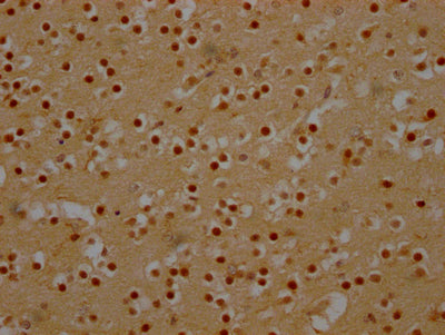 IHC image of RAC07288 diluted at 1:100 and staining in paraffin-embedded human brain tissue performed on a Leica BondTM system. After dewaxing and hydration, antigen retrieval was mediated by high pressure in a citrate buffer (pH 6.0). Section was blocked with 10% normal goat serum 30min at RT. Then primary antibody (1% BSA) was incubated at 4? overnight. The primary is detected by a Goat anti-rabbit IgG polymer labeled by HRP and visualized using 0.05% DAB.