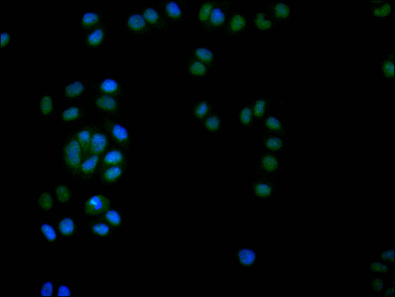 Immunofluorescence staining of Hela with RAC07290 at 1:20, counter-stained with DAPI. The cells were fixed in 4% formaldehyde and blocked in 10% normal Goat Serum. The cells were then incubated with the antibody overnight at 4Â°C. The secondary antibody was Alexa Fluor 524-congugated AffiniPure Goat Anti-Rabbit IgG(H+L).