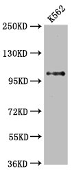 Western Blot; Positive WB detected in: K562 whole cell lysate; All lanes: DGCR8 antibody at 2.65ug/ml; Secondary; Goat polyclonal to rabbit IgG at 1/50000 dilution; Predicted band size: 87, 33, 83 KDa; Observed band size: 100 KDa