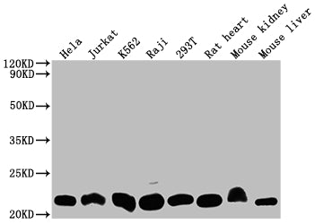 Western Blot; Positive WB detected in: Hela whole cell lysate, Jurkat whole cell lysate, K562 whole cell lysate, Raji whole cell lysate, 293T whole cell lysate, Rat heart tissue, Mouse kidney tissue, Mouse liver tissue; All lanes: DHFR antibody at 1:2000; Secondary; Goat polyclonal to rabbit IgG at 1/50000 dilution; Predicted band size: 22, 16 kDa; Observed band size: 22 kDa