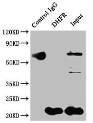 Immunoprecipitating DHFR in Hela whole cell lysate; Lane 1: Rabbit control IgG instead of RAC07292 in Hela whole cell lysate.For western blotting,a HRP-conjugated Protein G antibody was used as the secondary antibody (1/2000); Lane 2: RAC07292(2ug)+ Hela whole cell lysate(500ug); Lane 3: Hela whole cell lysate (10ug)