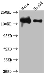 Western Blot; Positive WB detected in: Hela whole cell lysate, HepG2 whole cell lysate; All lanes: DNA Ligase I antibody at 1:1000; Secondary; Goat polyclonal to rabbit IgG at 1/50000 dilution; Predicted band size: 102, 89, 99 kDa; Observed band size: 140 kDa