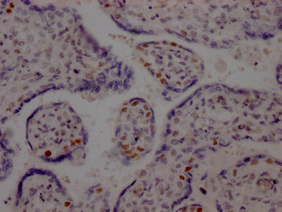 IHC image of RAC07294 diluted at 1:100 and staining in paraffin-embedded human placenta tissue performed on a Leica BondTM system. After dewaxing and hydration, antigen retrieval was mediated by high pressure in a citrate buffer (pH 6.0). Section was blocked with 10% normal goat serum 30min at RT. Then primary antibody (1% BSA) was incubated at 4? overnight. The primary is detected by a Goat anti-rabbit IgG polymer labeled by HRP and visualized using 0.05% DAB.