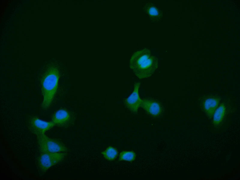Immunofluorescence staining of A549 cell with RAC07295 at 1:50, counter-stained with DAPI. The cells were fixed in 4% formaldehyde and blocked in 10% normal Goat Serum. The cells were then incubated with the antibody overnight at 4Â°C. The secondary antibody was Alexa Fluor 550-congugated AffiniPure Goat Anti-Rabbit IgG(H+L).
