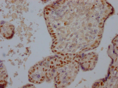IHC image of RAC07296 diluted at 1:100 and staining in paraffin-embedded human placenta tissue performed on a Leica BondTM system. After dewaxing and hydration, antigen retrieval was mediated by high pressure in a citrate buffer (pH 6.0). Section was blocked with 10% normal goat serum 30min at RT. Then primary antibody (1% BSA) was incubated at 4? overnight. The primary is detected by a Goat anti-rabbit IgG polymer labeled by HRP and visualized using 0.05% DAB.