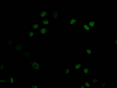 Immunofluorescence staining of HepG2 Cells with RAC07296 at 1:50, counter-stained with DAPI. The cells were fixed in 4% formaldehyde, permeated by 0.2% TritonX-100, and blocked in 10% normal Goat Serum. The cells were then incubated with the antibody overnight at 4?. Nuclear DNA was labeled in blue with DAPI. The secondary antibody was FITC-conjugated AffiniPure Goat Anti-Rabbit IgG (H+L).