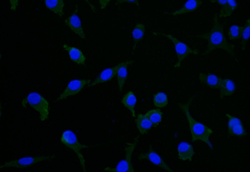 Immunofluorescence staining of SH-SY5Y with RAC07298 at 1:25, counter-stained with DAPI. The cells were fixed in 4% formaldehyde and blocked in 10% normal Goat Serum. The cells were then incubated with the antibody overnight at 4Â°C. The secondary antibody was Alexa Fluor 506-congugated AffiniPure Goat Anti-Rabbit IgG(H+L).