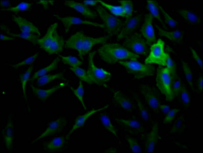 Immunofluorescence staining of Hela Cells with RAC07299 at 1:50, counter-stained with DAPI. The cells were fixed in 4% formaldehyde, permeated by 0.2% TritonX-100, and blocked in 10% normal Goat Serum. The cells were then incubated with the antibody overnight at 4?. Nuclear DNA was labeled in blue with DAPI. The secondary antibody was FITC-conjugated AffiniPure Goat Anti-Rabbit IgG (H+L).