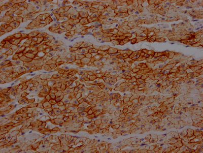IHC image of RAC07301 diluted at 1:100 and staining in paraffin-embedded human heart tissue performed on a Leica BondTM system. After dewaxing and hydration, antigen retrieval was mediated by high pressure in a citrate buffer (pH 6.0). Section was blocked with 10% normal goat serum 30min at RT. Then primary antibody (1% BSA) was incubated at 4? overnight. The primary is detected by a Goat anti-rabbit IgG polymer labeled by HRP and visualized using 0.05% DAB.