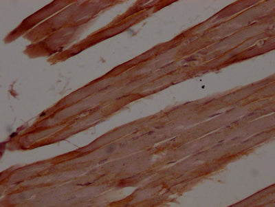 IHC image of RAC07301 diluted at 1:100 and staining in paraffin-embedded human skeletal muscle tissue performed on a Leica BondTM system. After dewaxing and hydration, antigen retrieval was mediated by high pressure in a citrate buffer (pH 6.0). Section was blocked with 10% normal goat serum 30min at RT. Then primary antibody (1% BSA) was incubated at 4? overnight. The primary is detected by a Goat anti-rabbit IgG polymer labeled by HRP and visualized using 0.05% DAB.