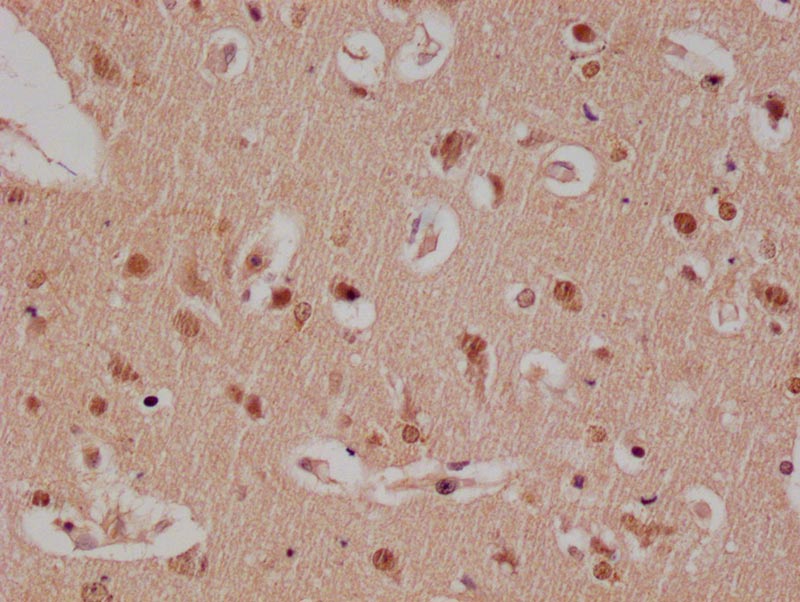 IHC image of RAC07303 diluted at 1:100 and staining in paraffin-embedded human brain tissue performed on a Leica BondTM system. After dewaxing and hydration, antigen retrieval was mediated by high pressure in a citrate buffer (pH 6.0). Section was blocked with 10% normal goat serum 30min at RT. Then primary antibody (1% BSA) was incubated at 4Â°C overnight. The primary is detected by a Goat anti-rabbit polymer IgG labeled by HRP and visualized using 0.05% DAB.