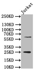 Western Blot; Positive WB detected in: JK whole cell lysate; All lanes: EBI3 antibody at 1:500; Secondary; Goat polyclonal to rabbit IgG at 1/50000 dilution; Predicted band size: 25 kDa; Observed band size: 25 kDa