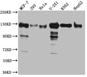 Western Blot; Positive WB detected in: MCF-7 whole cell lysate, 293 whole cell lysate, Hela whole cell lysate, U-251 whole cell lysate, K562 whole cell lysate, HepG2 whole cell lysat; All lanes: Eg5 Antibody at 1:1000; Secondary; Goat polyclonal to rabbit IgG at 1/50000 dilution; Predicted band size: 120 kDa; Observed band size: 130 kDa