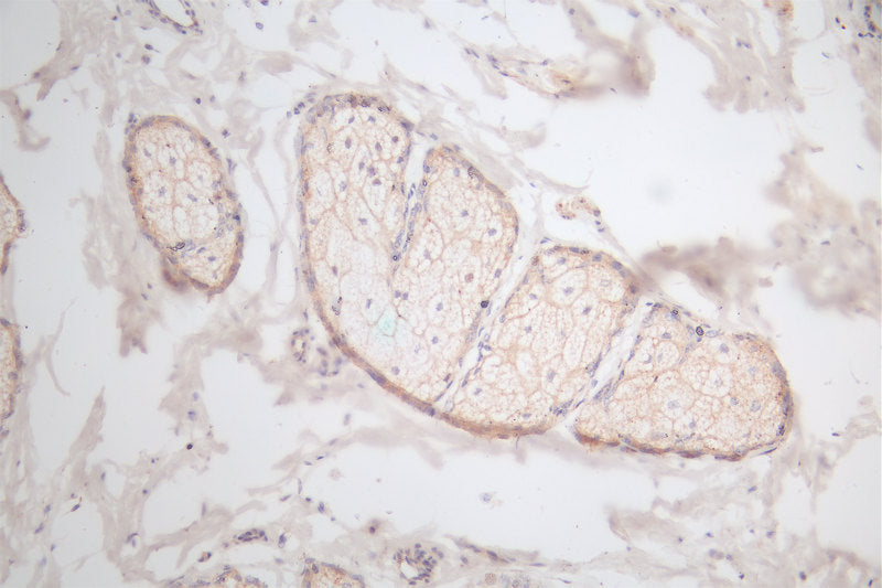 IHC image of RAC07307 diluted at 1:100 and staining in paraffin-embedded human skin tissue performed on a Leica BondTM system. After dewaxing and hydration, antigen retrieval was mediated by high pressure in a citrate buffer (pH 6.0). Section was blocked with 10% normal goat serum 30min at RT. Then primary antibody (1% BSA) was incubated at 4Â°C overnight. The primary is detected by a Goat anti-rabbit polymer IgG labeled by HRP and visualized using 0.66% DAB.